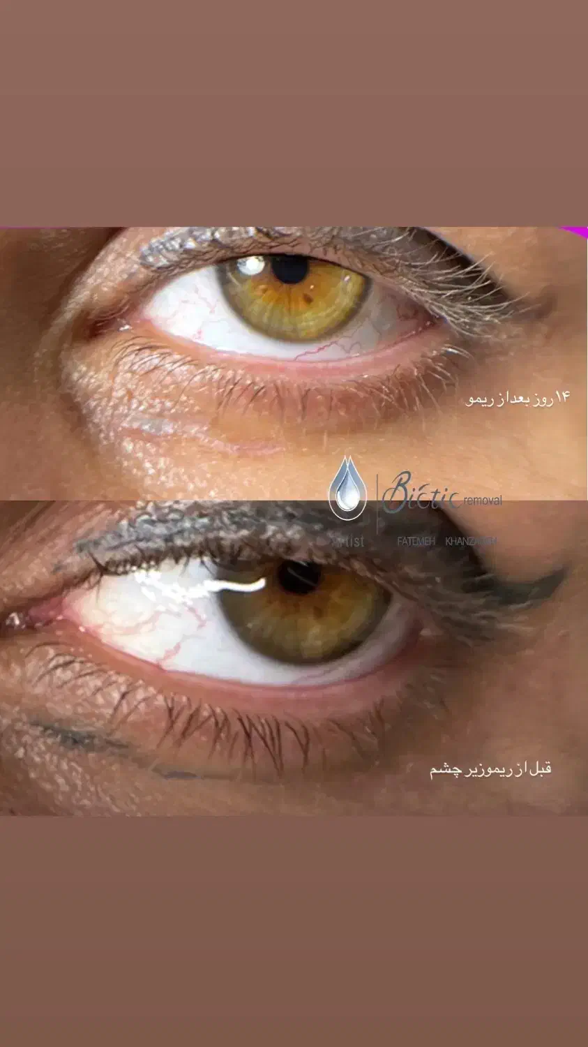 پونصد هزار تومان تخفیف روی خدمات ریمو|خدمات آرایشگری و زیبایی|شیراز, شریف‌آباد|دیوار