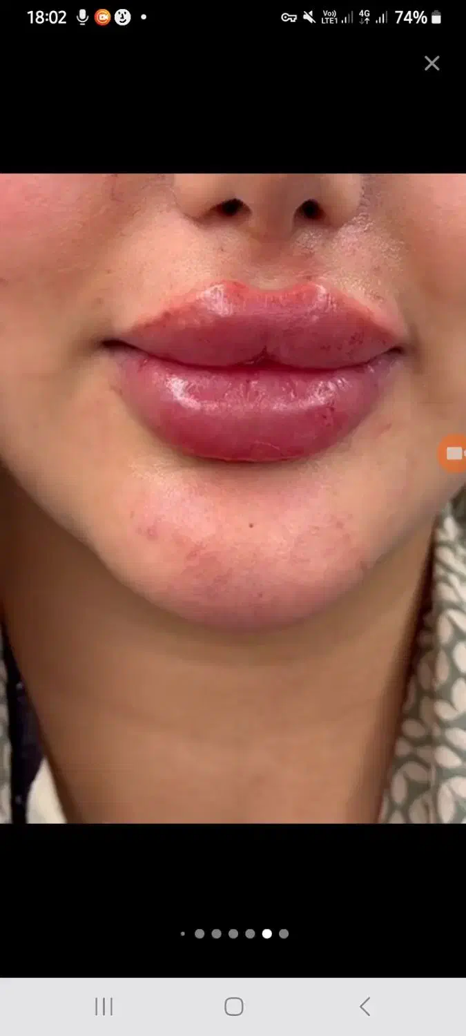 مدل ژل لب روسی۳۵۰ونخ لیفت۷۰۰وو فول فیس وژل بادی۵۰۰|خدمات آرایشگری و زیبایی|تهران, آهنگ|دیوار