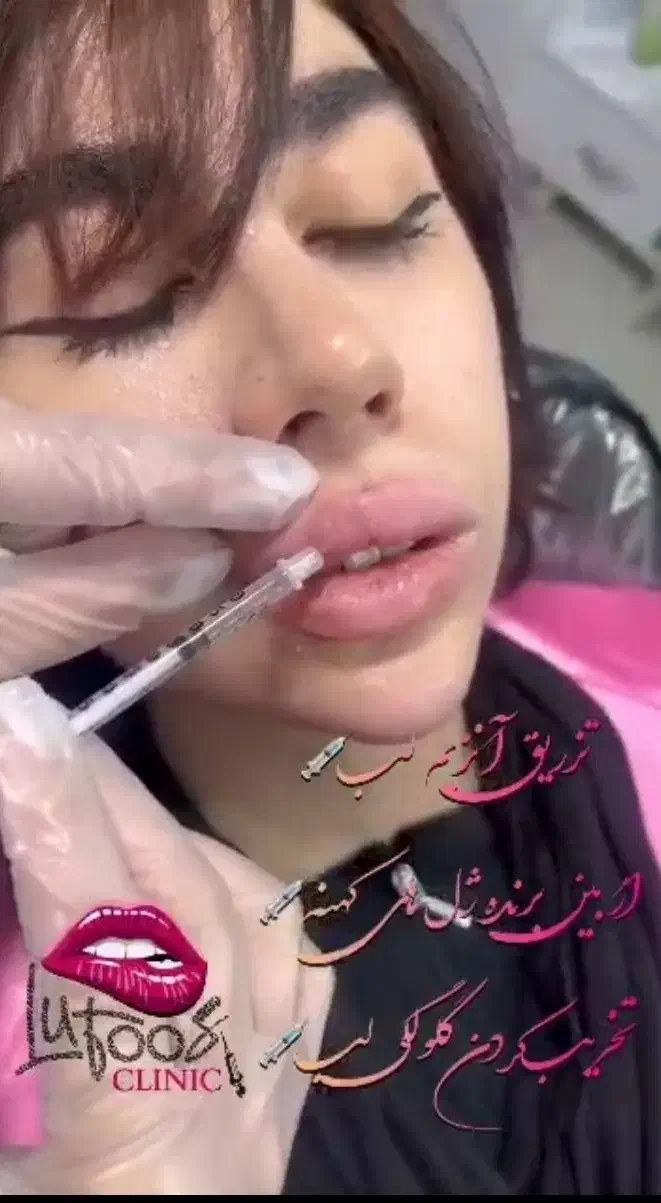 آموزش تخصصی ژل و بوتاکس|خدمات آموزشی|نهاوند, |دیوار