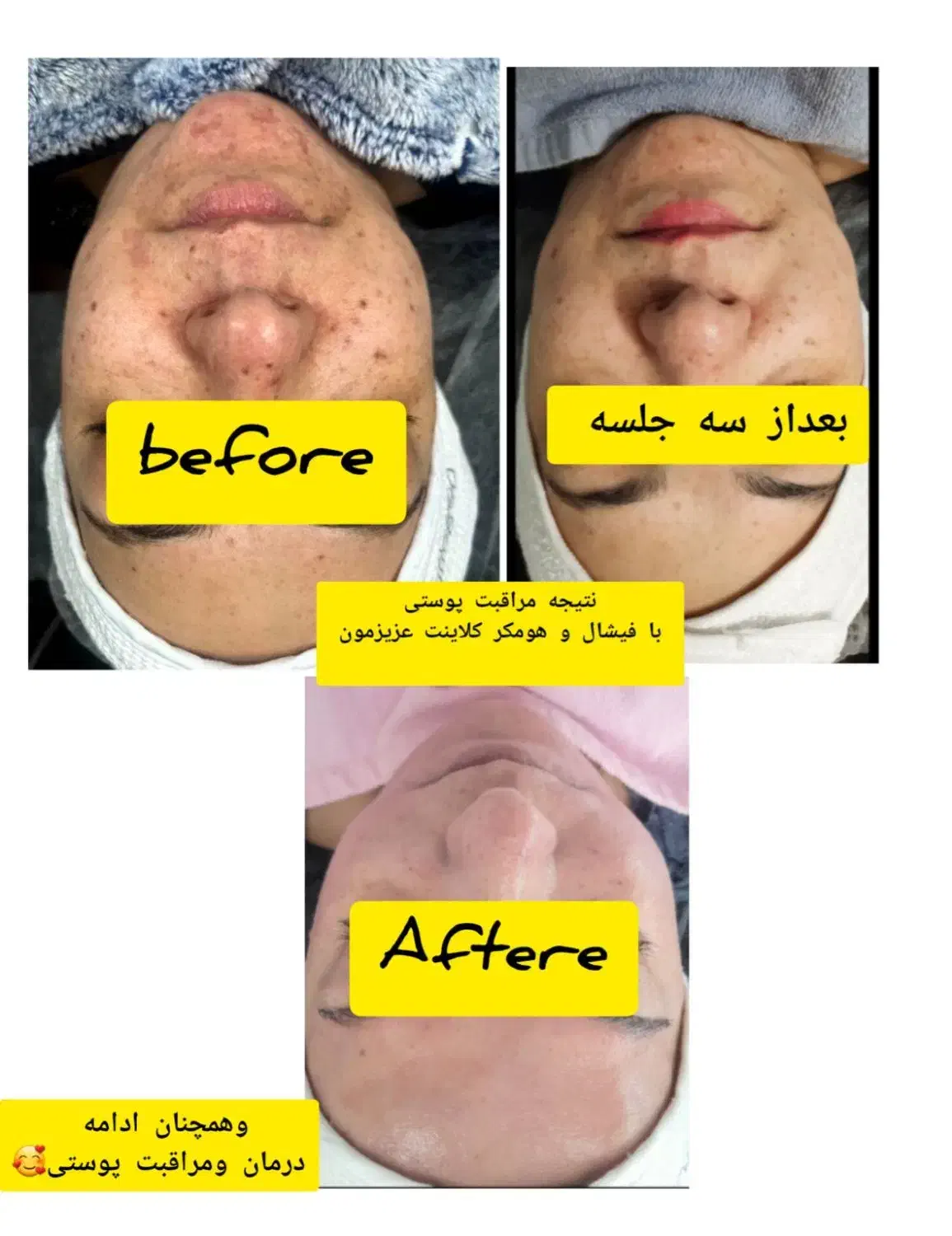 پاکسازی وفیشال تخصصی|خدمات آرایشگری و زیبایی|بومهن, |دیوار