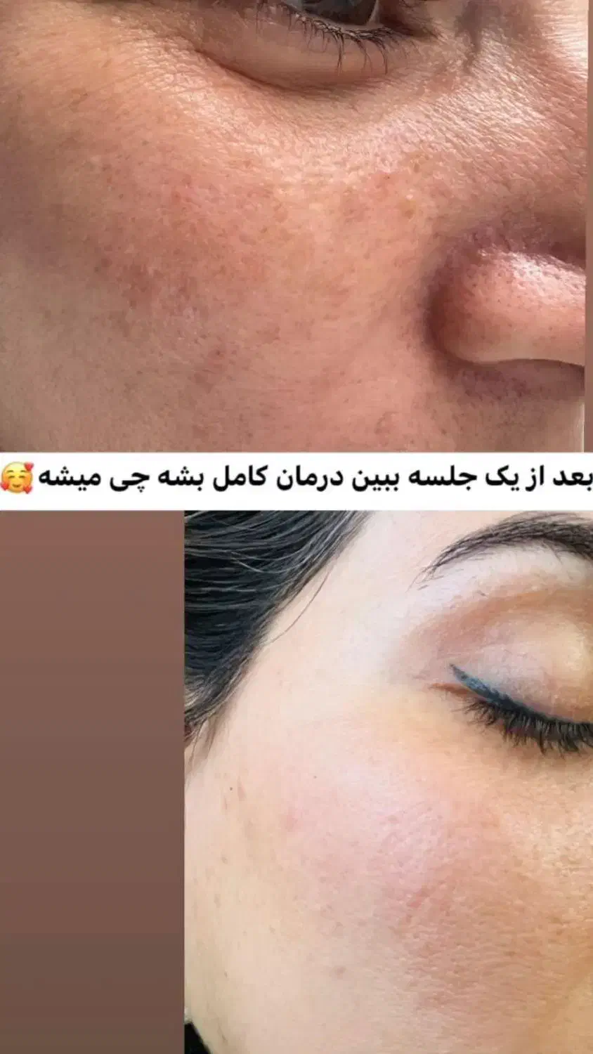 درمان ناهنجاری پوست و آموزش خاویار تراپی|خدمات آرایشگری و زیبایی|شیراز, باهنر|دیوار