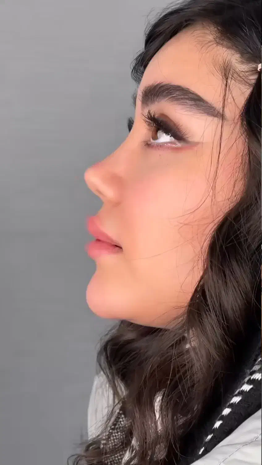 تخفیف ویژه عمل بینی/لیفت/لیپو/ابدو/پیکرتراشی|خدمات آرایشگری و زیبایی|کاشان, امیرکبیر|دیوار