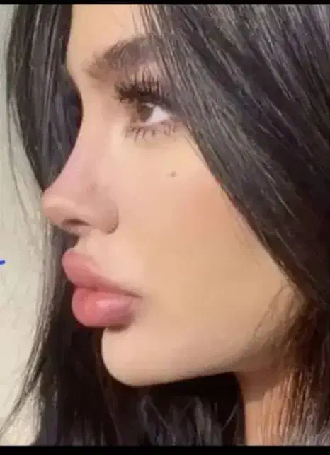 تخفیف عمل بینی لیپو ابدو ساکشن پیکرتراشی و لیفت|خدمات آرایشگری و زیبایی|بروجرد, |دیوار