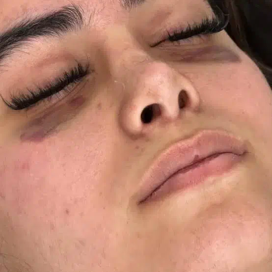 دعوت به همکاری از جراح دارای پروانه تهران|استخدام درمانی، زیبایی، بهداشتی|تهران, ونک|دیوار