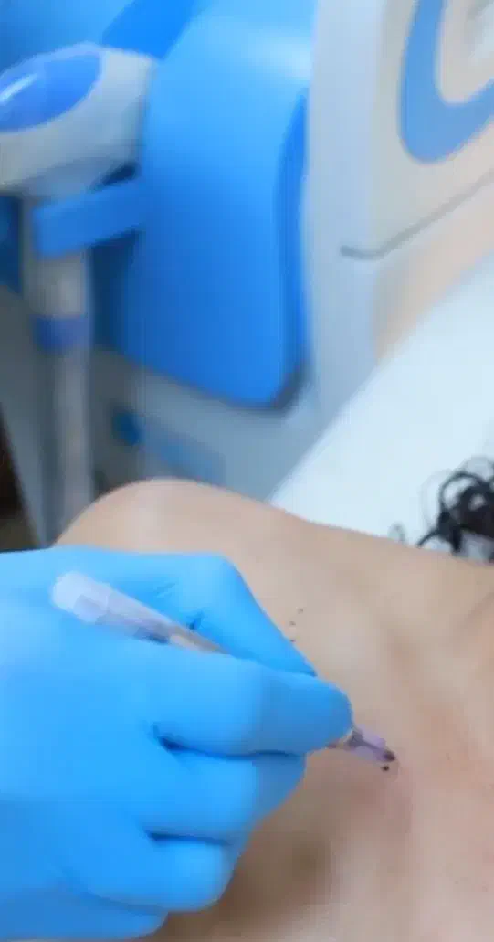 لیزر موهای زاید|خدمات آرایشگری و زیبایی|بوشهر, |دیوار