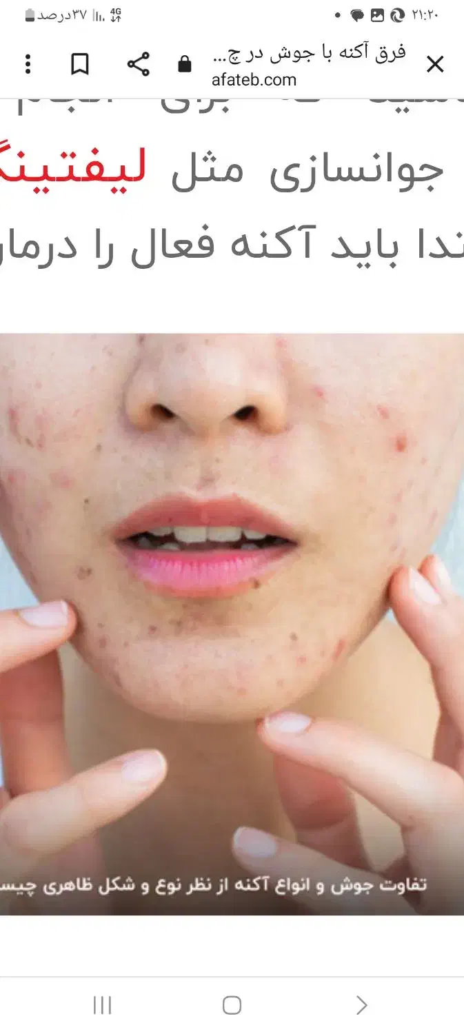 راهنمایی برای سلامتی پوست|فعالیت داوطلبانه|تبریز, |دیوار