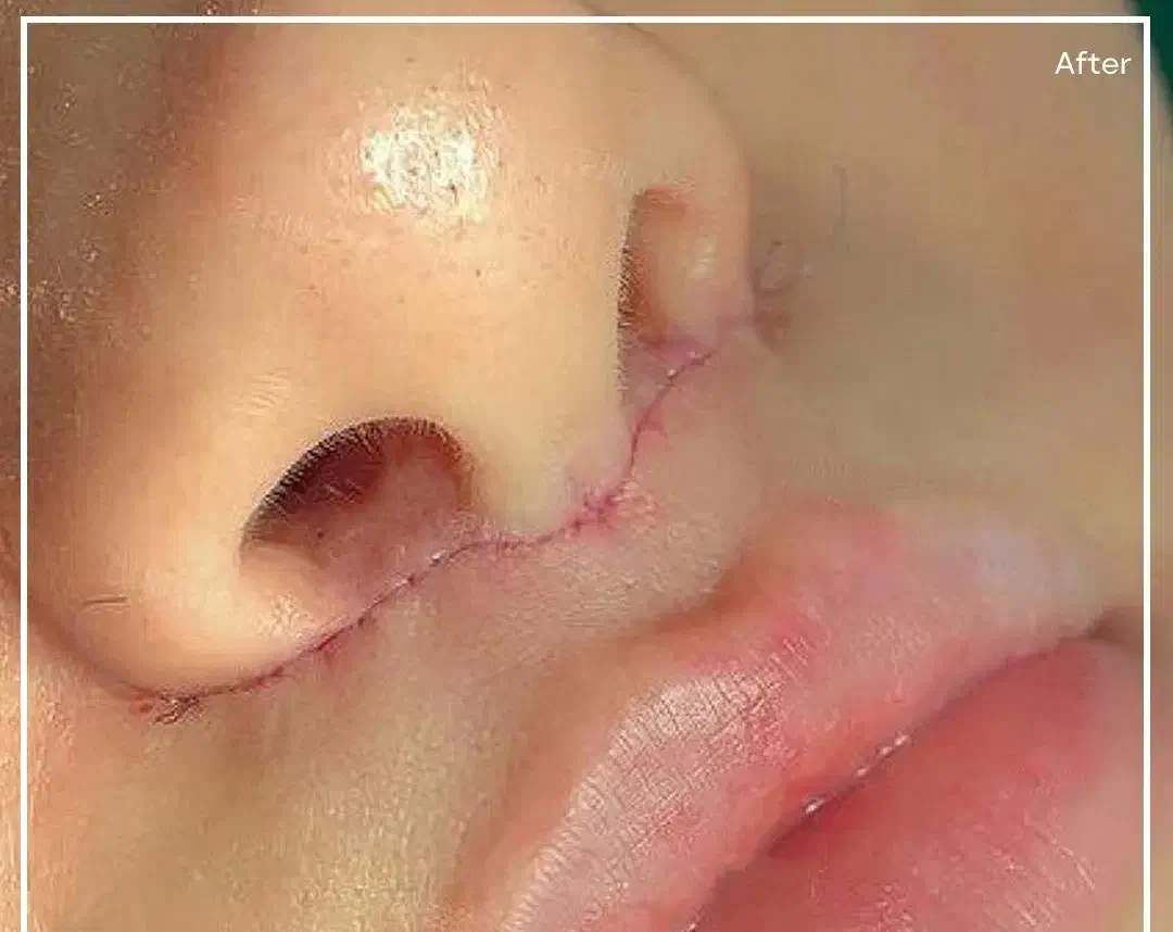 انجام تمام خدمات زیبایی صورت وبدن|خدمات آرایشگری و زیبایی|شاهیوند, |دیوار