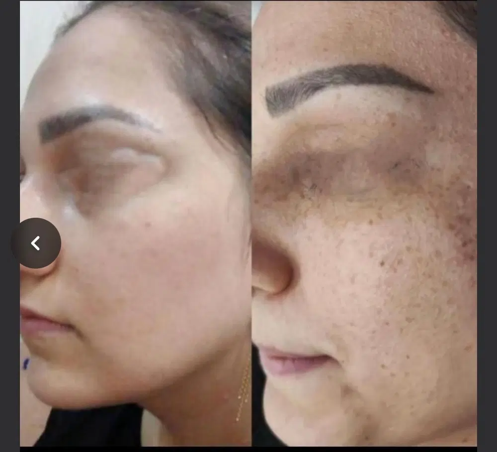 تخصصی ترین حرفه ای ترین مرکزدرمان انواع لک وکک مک|خدمات زیبایی و سلامت|تهران, سیزده آبان|دیوار