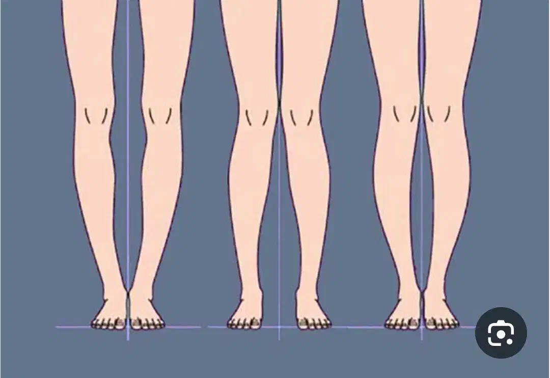 مرکز تخصصی اصلاح غیرجراحی انحرافات زانو|خدمات آرایشگری و زیبایی|بهار, |دیوار