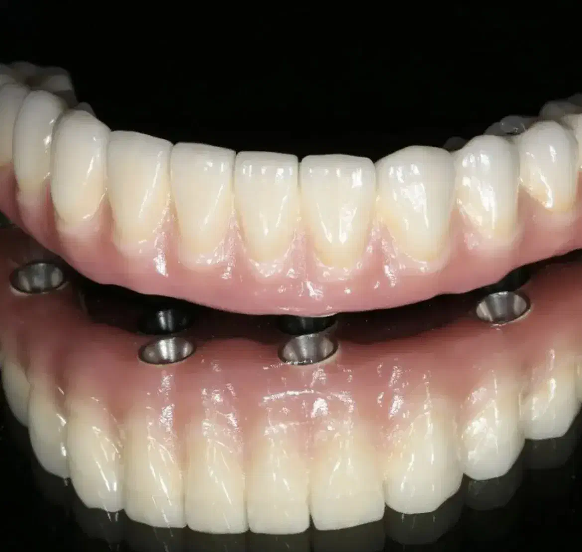 ایمپلنت،اوردنچر دو فک ۱۰۰ تومن در تبریز|خدمات آرایشگری و زیبایی|اهر, |دیوار