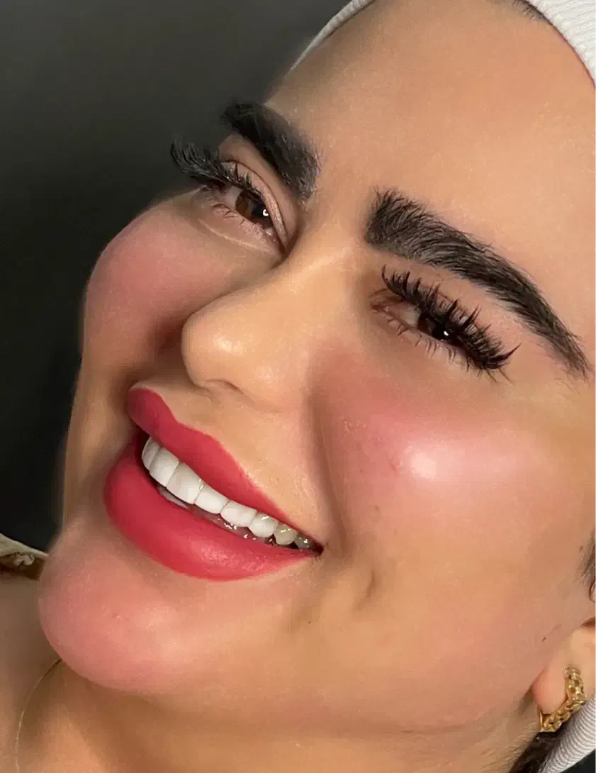 بوتاکس فیلرژل لب گونه چانه زاویه فک و صورت مادلینگ|خدمات آرایشگری و زیبایی|تهران, تهرانپارس غربی|دیوار