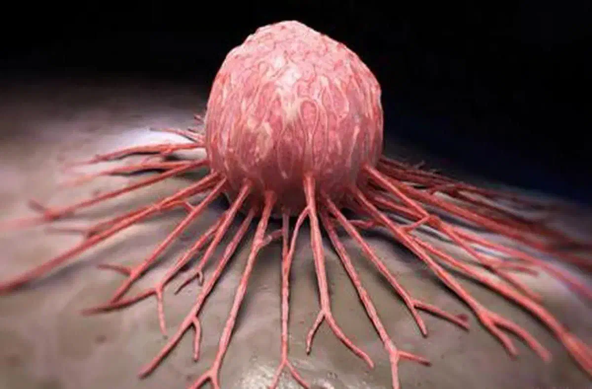 درمان تضمینی پروستات و مشکلات ادرار|خدمات آرایشگری و زیبایی|بم, |دیوار