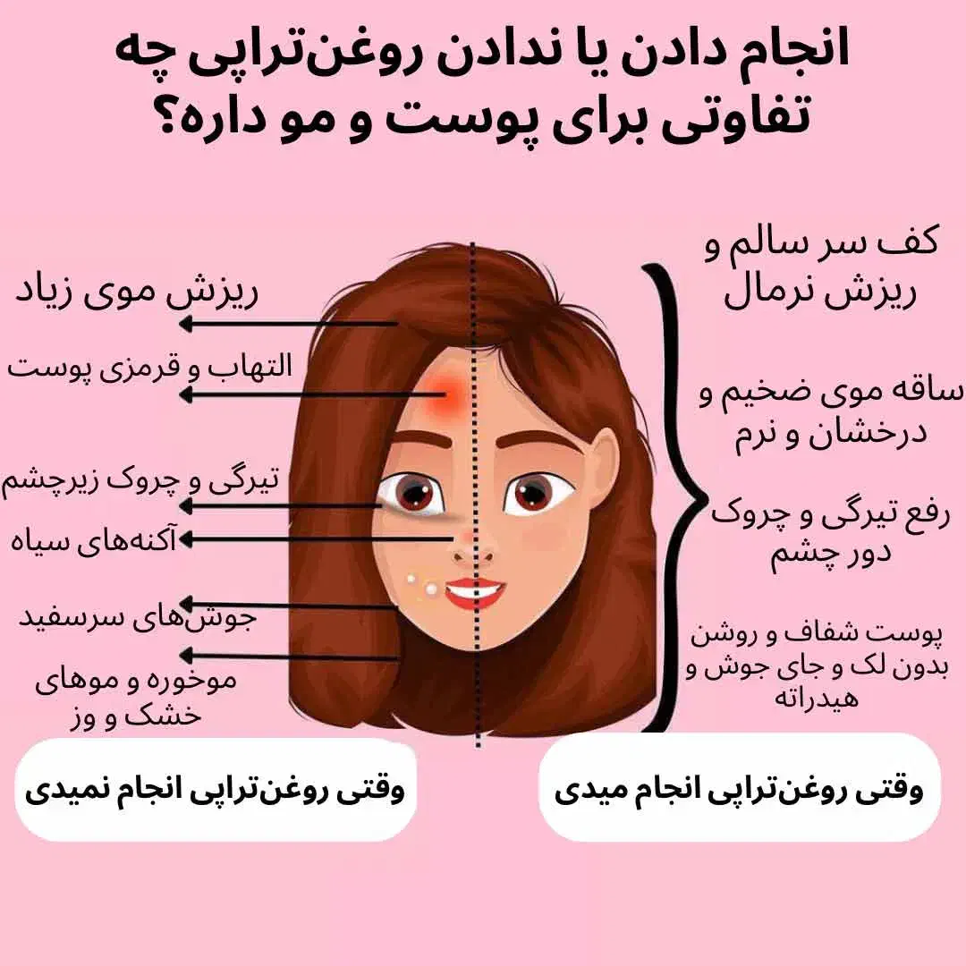 روغن تراپی|آرایشی، بهداشتی، درمانی|قم, صدوق|دیوار