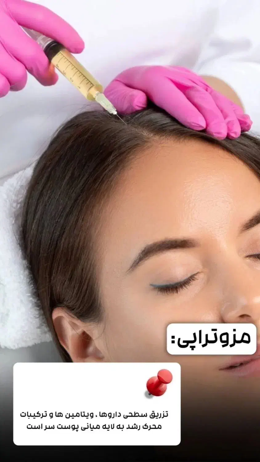 پی آر پی و مزوتراپی با بالاترین کیفیت|خدمات آرایشگری و زیبایی|اهواز, زیتون کارمندی|دیوار