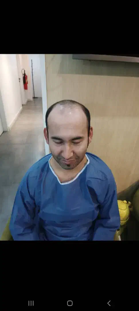 کلینیک کاشت مو|خدمات آرایشگری و زیبایی|مریوان, |دیوار