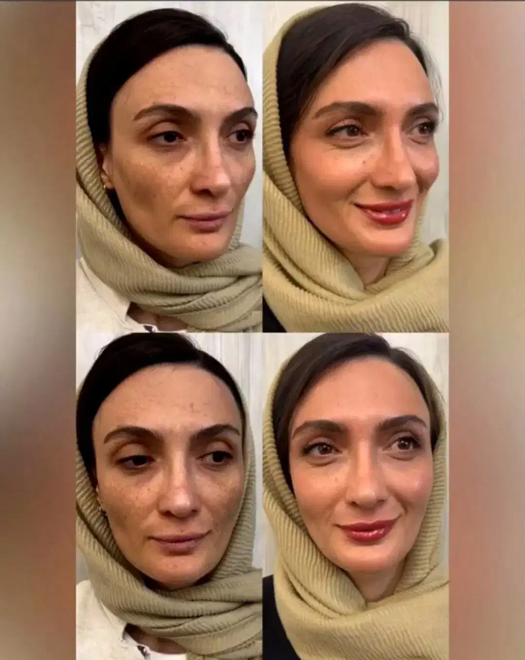 کرم ضدلک لاکچری کوین اصل نمایندگی کوثر|آرایشی، بهداشتی، درمانی|کوثر, |دیوار