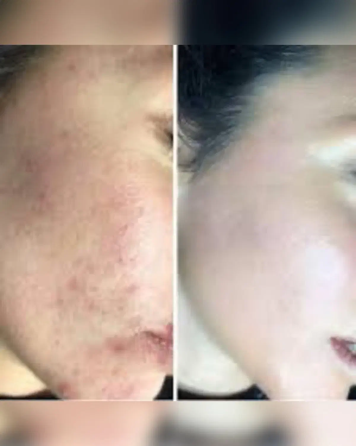 روشن کننده صورت و ضدلک قوی|آرایشی، بهداشتی، درمانی|اهواز, امانیه|دیوار