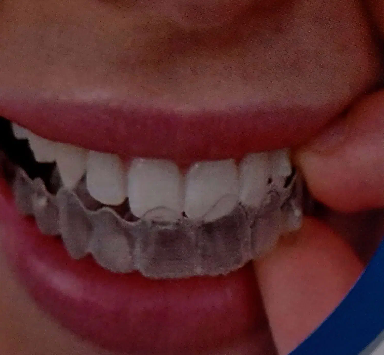 لابراتوار دندانسازی|آرایشی، بهداشتی، درمانی|آشخانه, |دیوار