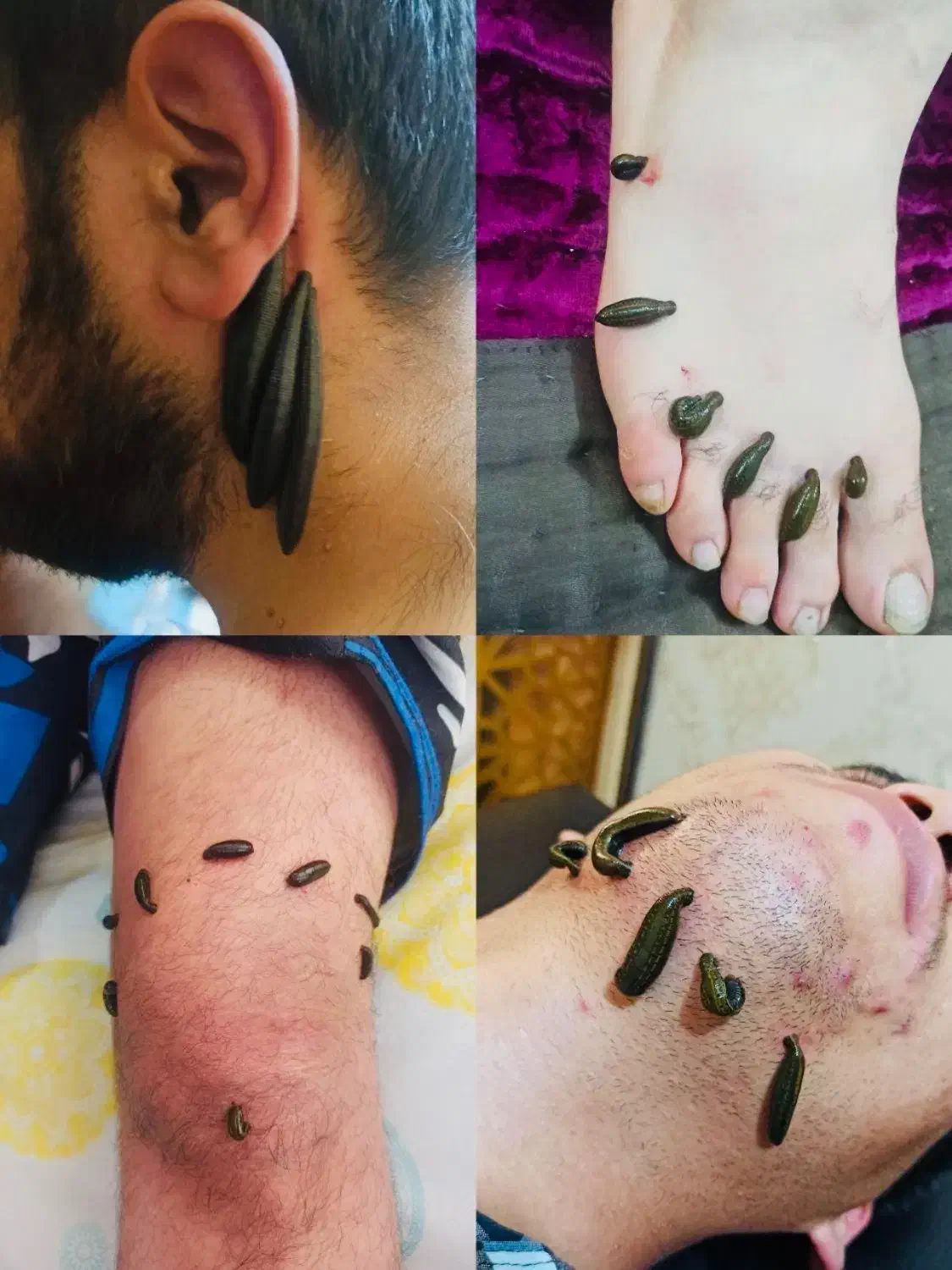 دیسک سیاتیک فیزیوتراپی کاردرمانی زالو درمانی حجامت|خدمات آرایشگری و زیبایی|تهران, ارامنه|دیوار