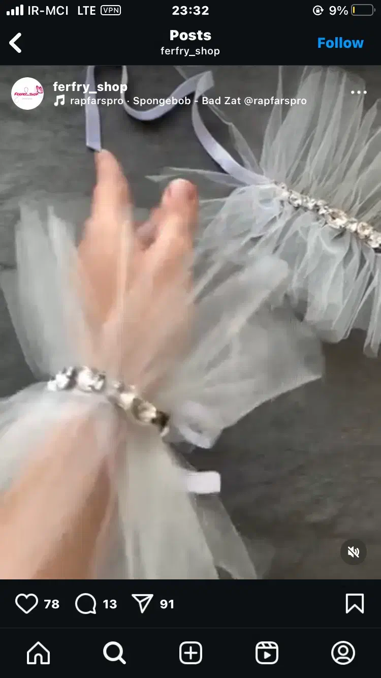 مچ بند های توری|لباس|ارومیه, |دیوار