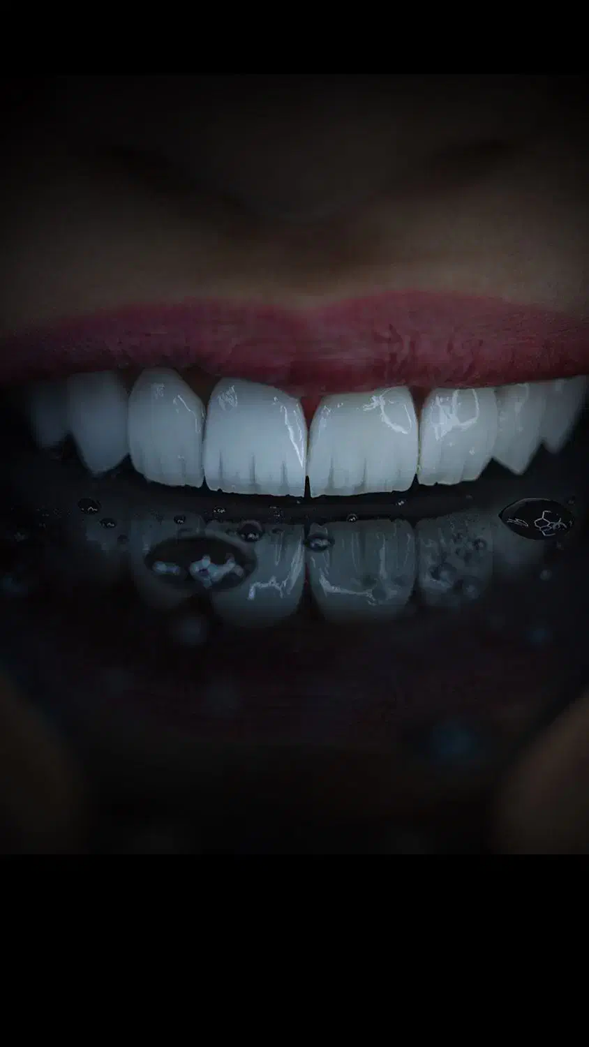 جشنواره پاییزه کامپوزیت،لمینیت،ایمپلنت اقساط|خدمات آرایشگری و زیبایی|بومهن, |دیوار