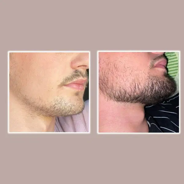 کوسه نباش|آرایشی، بهداشتی، درمانی|اصفهان, چرخاب|دیوار