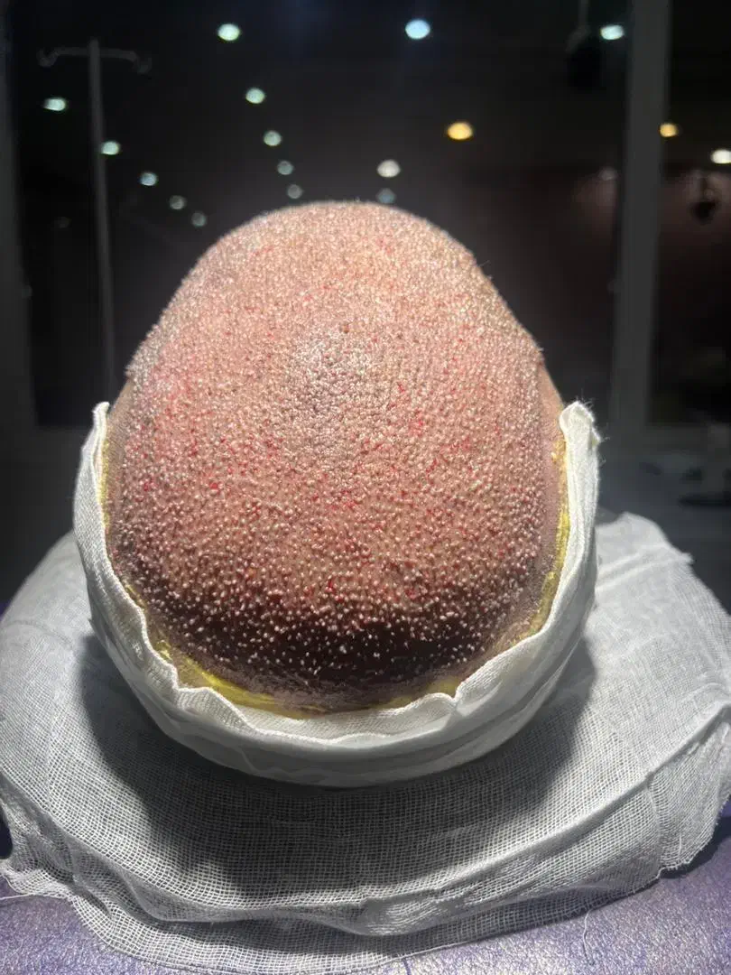 کاشت مو|خدمات آرایشگری و زیبایی|تکاب, |دیوار