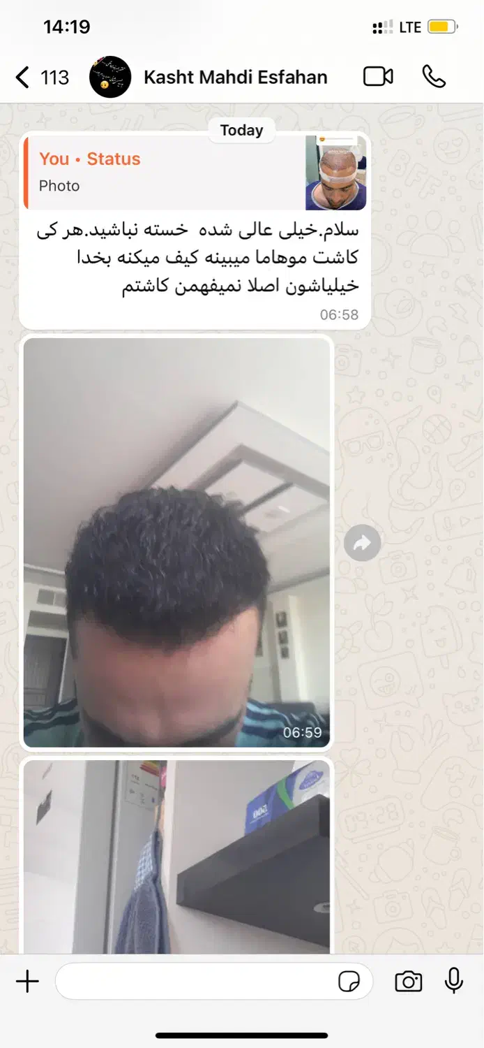 کاشتمو تضمینی شیراز|خدمات آرایشگری و زیبایی|شیراز, قصرالدشت|دیوار