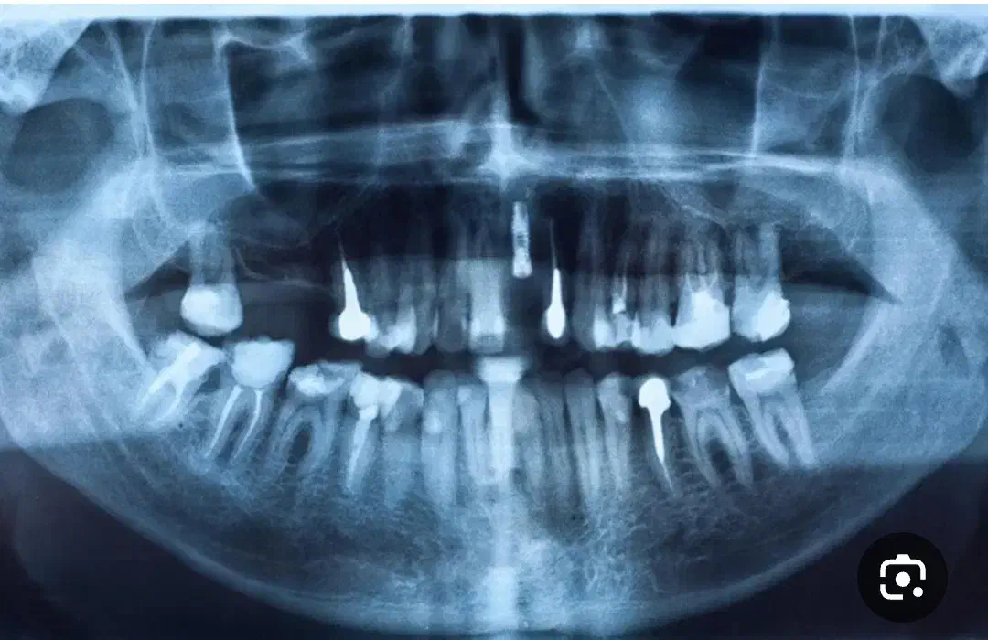 مسوول بیمه جهت درمانگاه دندانپزشکی|استخدام درمانی، زیبایی، بهداشتی|قدس, شهرقدس|دیوار