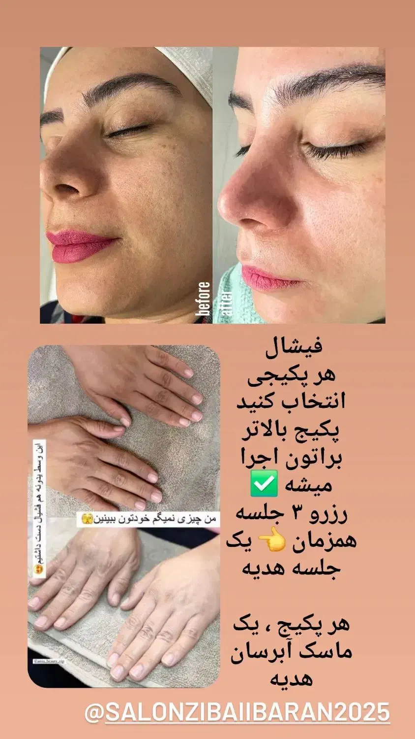 پاکسازی صورت، کمر، دست وپا|خدمات آرایشگری و زیبایی|لولمان, |دیوار