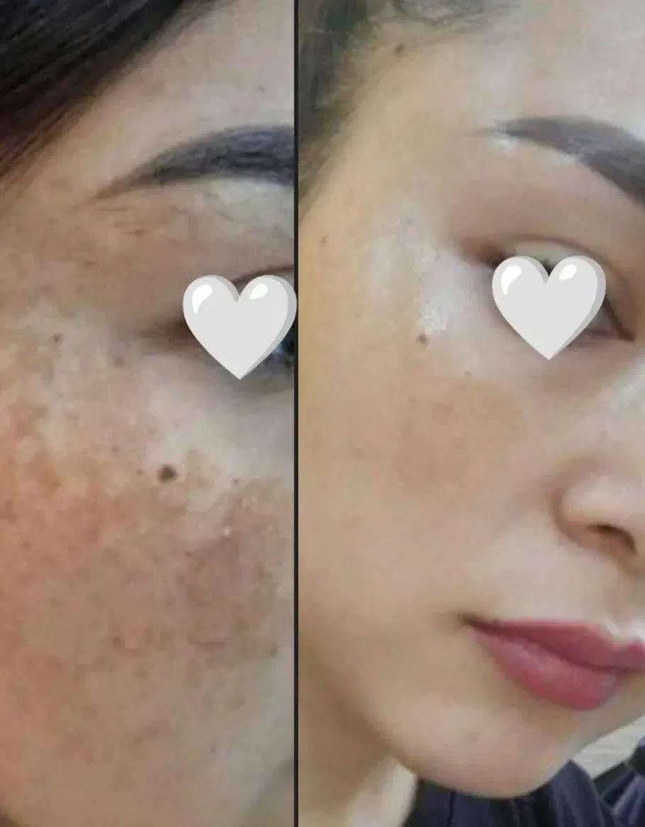 ضد لک  بیومیمتیک|آرایشی، بهداشتی، درمانی|اهواز, امانیه|دیوار