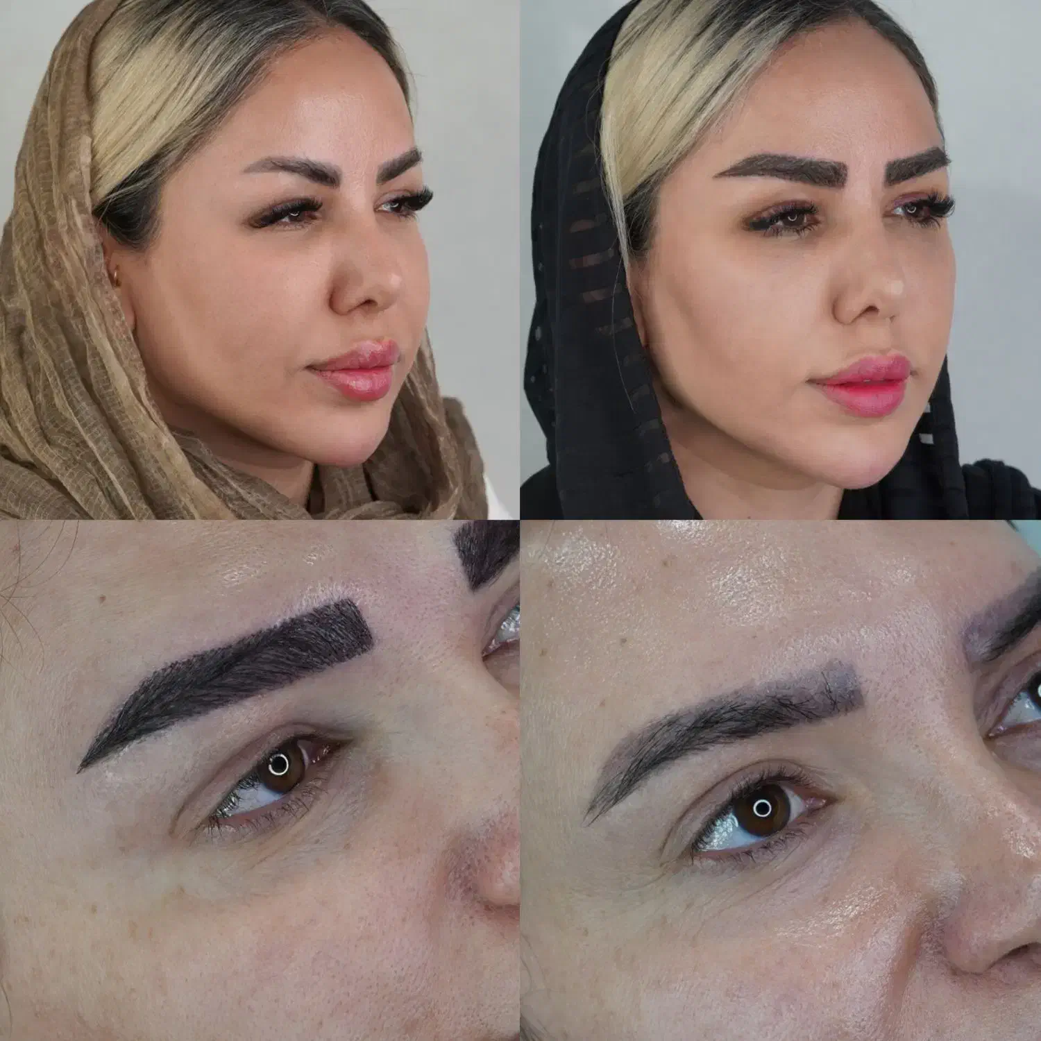 خدمات کاشت مو و ابرو به صورت اقساط|خدمات آرایشگری و زیبایی|شیراز, معالی‌آباد|دیوار
