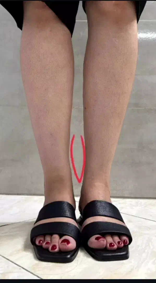 فیلرباسن هیپ دیپ ۱۲۰سیسی ۱۲میلیون تا آخر مهر|آرایشی، بهداشتی، درمانی|تبریز, |دیوار