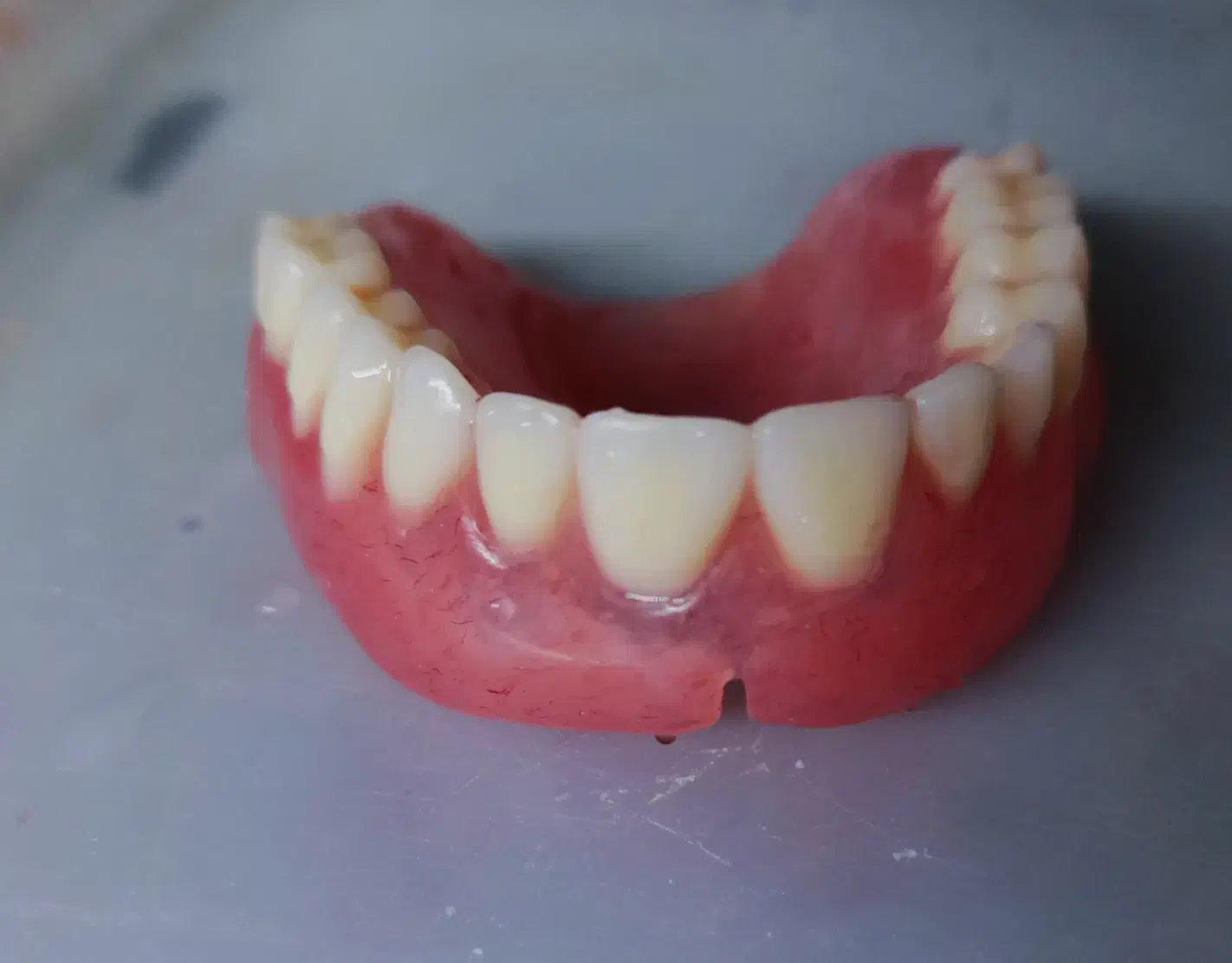 دندان مصنوعی متحرک|خدمات آرایشگری و زیبایی|شهرکرد, |دیوار