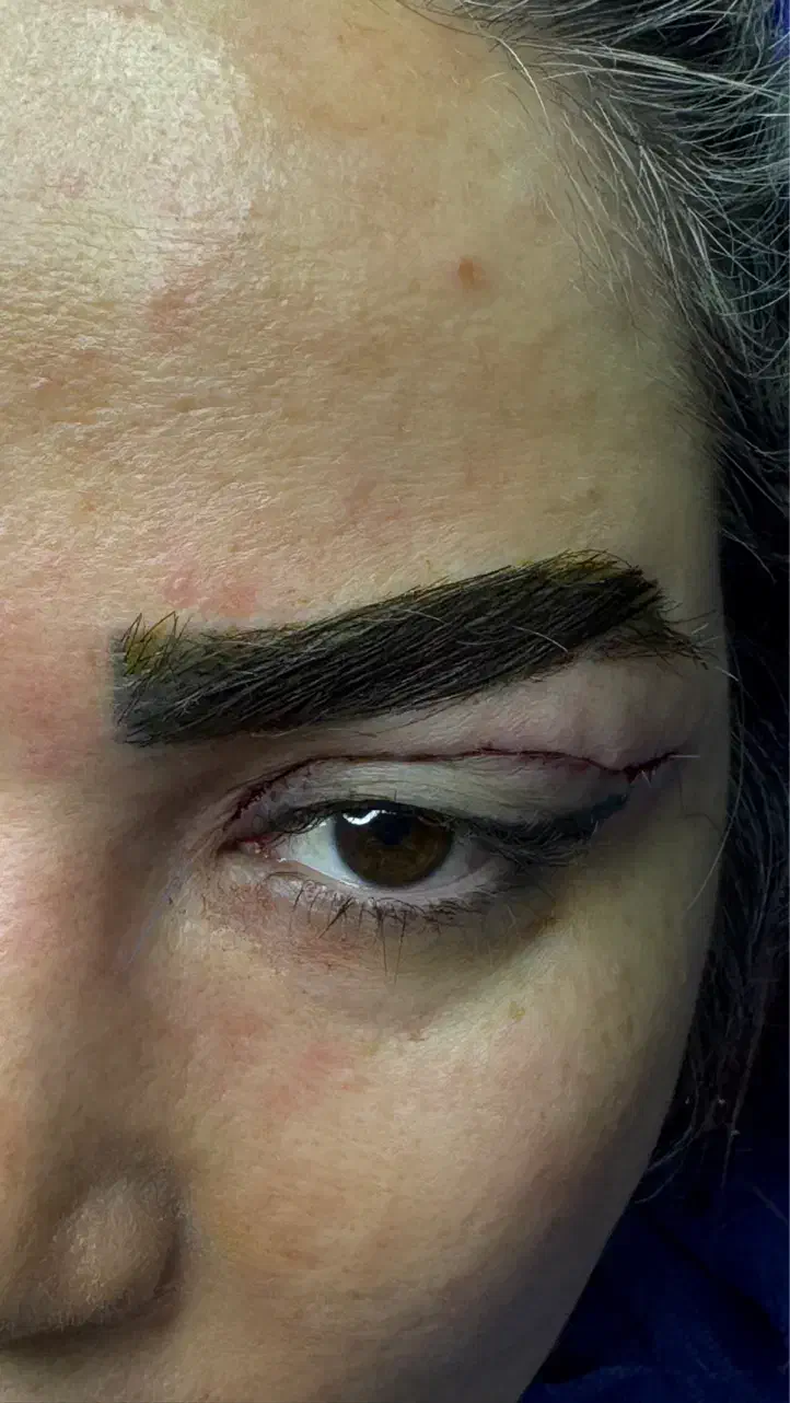 انواع جراحی های زیبایی صورت و بدن|خدمات آرایشگری و زیبایی|رشت, آتشگاه|دیوار