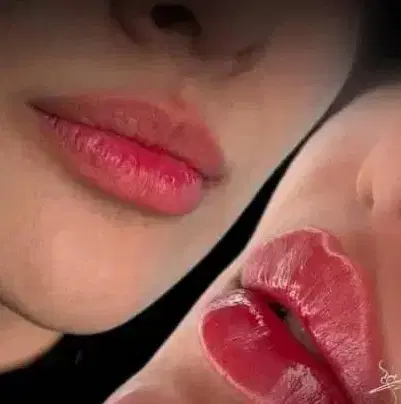 جشنواره بوتاکس و ژل لب مهلت دو روز|خدمات زیبایی و سلامت|تهران, صادقیه|دیوار