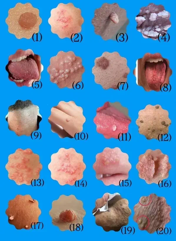 از زائده هات خداحافظی کن|آرایشی، بهداشتی، درمانی|رودبار, |دیوار