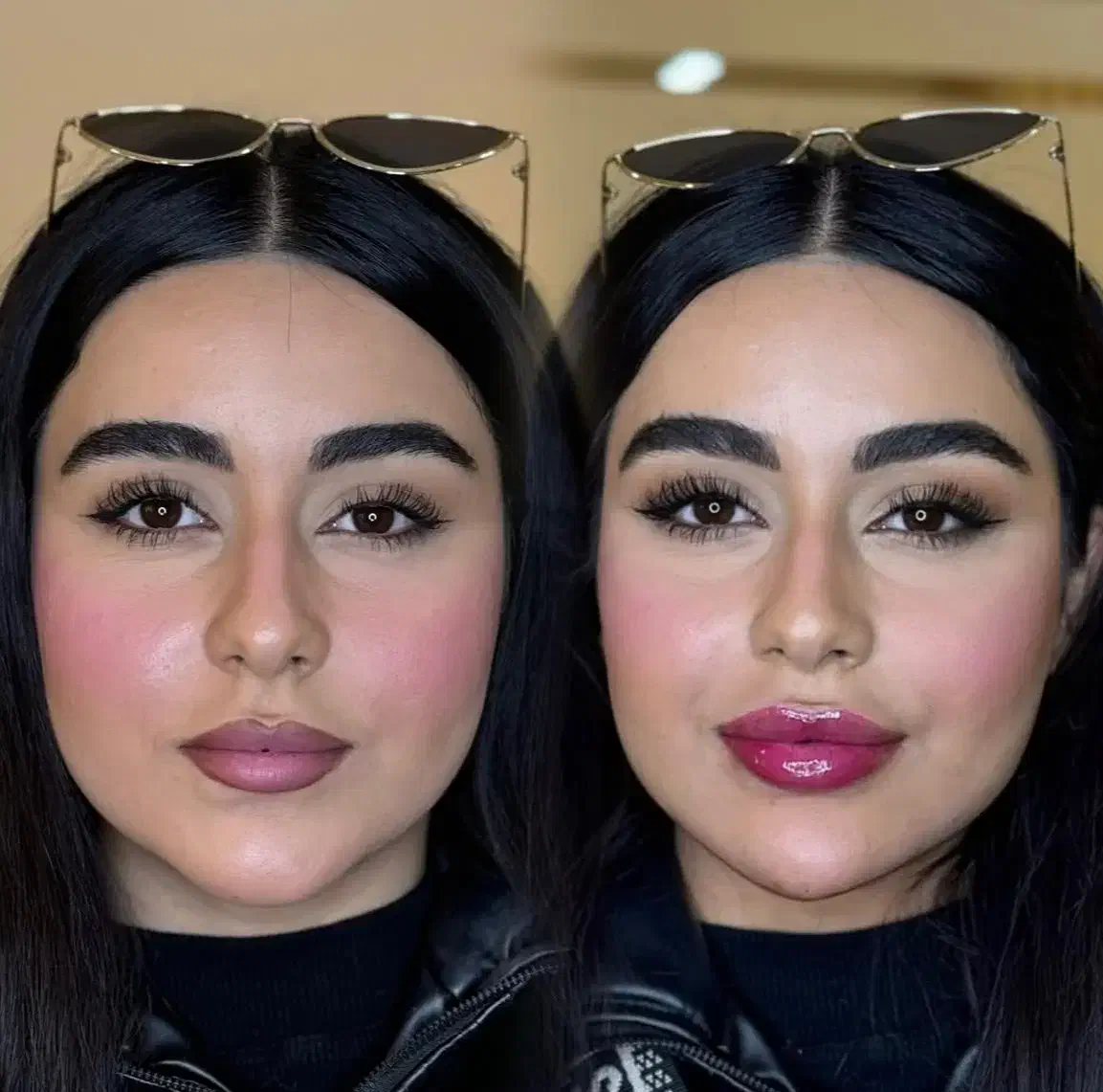 جشنواره ژل و بوتاکس با قیمت باورنکردنی/اقساط|خدمات آرایشگری و زیبایی|آمل, |دیوار