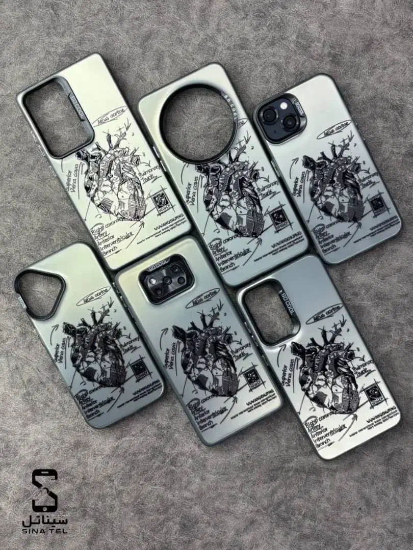 خرید هرگارد مساوی با گلس رایگان|لوازم جانبی موبایل و تبلت|یزد, |دیوار