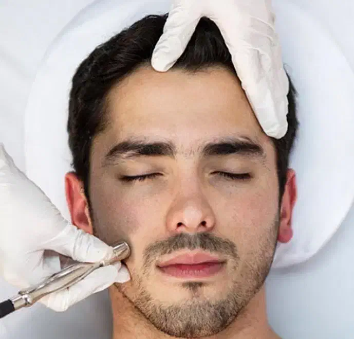 ۲۵٪تخفیف یلدایی پاکسازی پوست صورت اقایان حرفه ایی|خدمات آرایشگری و زیبایی|ایلام, |دیوار