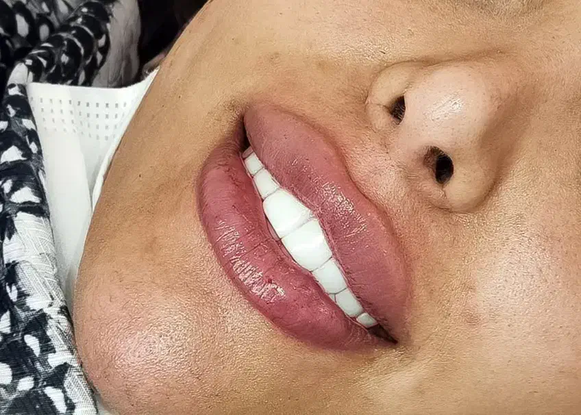 خدمات ژل و بوتاکس|خدمات آرایشگری و زیبایی|بهبهان, |دیوار