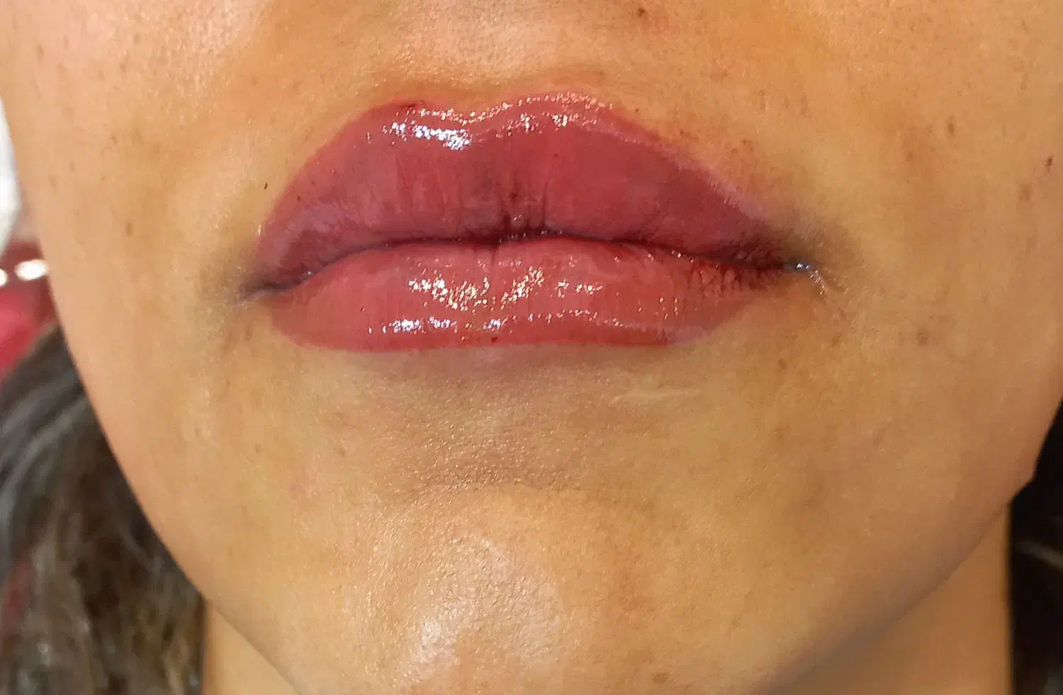 نیازمند به دو مدل برای تزریق فیلر لب زیر نظر پزشک|استخدام درمانی، زیبایی، بهداشتی|شیراز, قصرالدشت|دیوار