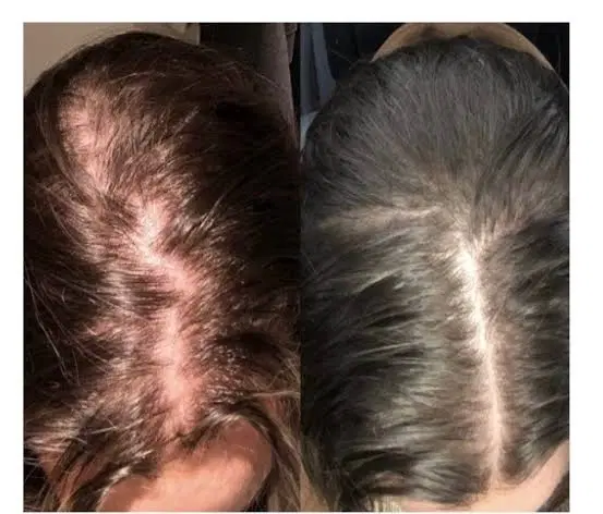 مزوژل جوانساز پوستتو جوان کن prp۹۸۰|خدمات زیبایی و سلامت|اصفهان, بهار آزادی|دیوار