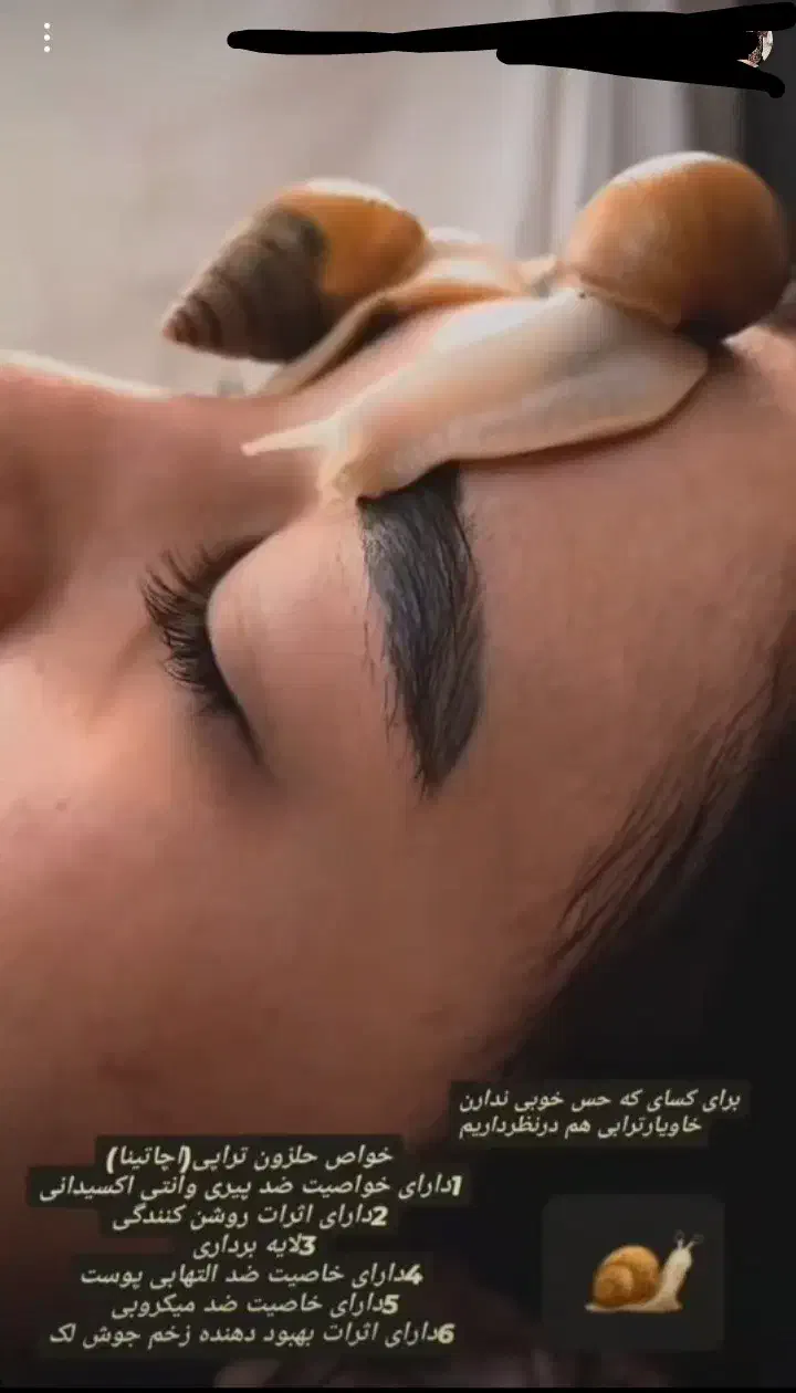 حلزون تراپی|آرایشی، بهداشتی، درمانی|محمدشهر, محمدشهر|دیوار