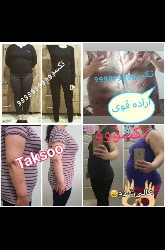 درمان لاغری آسان مثل کوره چربی بسوزنید|آرایشی، بهداشتی، درمانی|گنبد کاووس, |دیوار