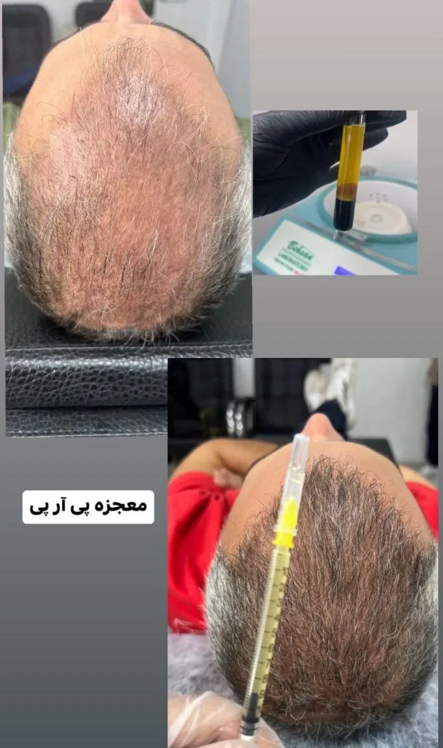 ژل بوتاکس آموزش تخصصی در مطب|خدمات آرایشگری و زیبایی|اصفهان, شهرک کاوه|دیوار
