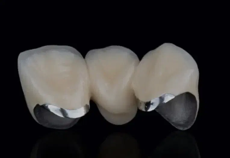 ایمپلنت مادام العمر|آرایشی، بهداشتی، درمانی|تهران, تهرانپارس جنوبی|دیوار