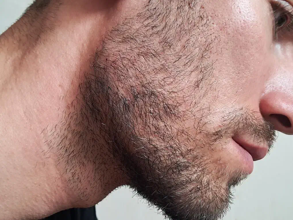 تزریق ژل لب وکانتورینگ(+بوتاکس رایگان|خدمات آرایشگری و زیبایی|کرمانشاه, |دیوار