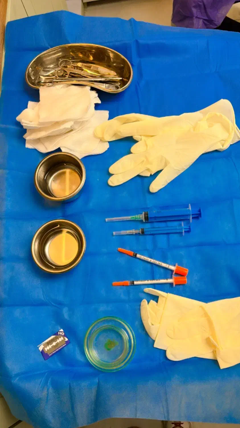 نیروی دستیار کاشت مو|استخدام درمانی، زیبایی، بهداشتی|گرگان, |دیوار