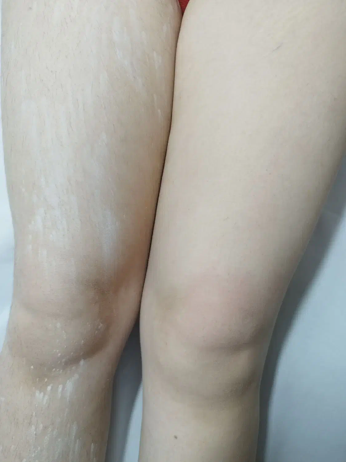 مرکز اپیلاسیون تخصصی بانوان در قاسم آباد|خدمات آرایشگری و زیبایی|مشهد, شهرک رازی (شهرک غرب)|دیوار